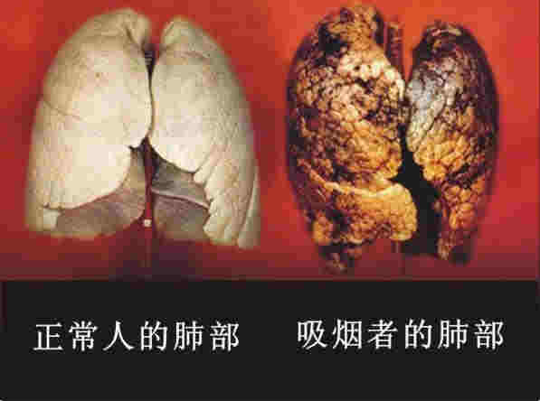 抽電子煙生痰怎么回事