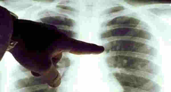 電子煙又出事了！贛州警方依法刑拘4人