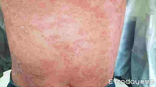 臺灣媒體讓電子霧化煙看起來比吸煙更危險 